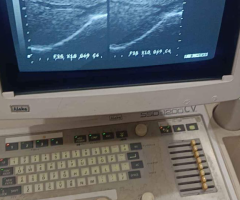 Ultrasound Machine for sale, Contact; 0302-5698121