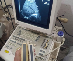 Toshiba ultrasound machine for sale, CONTACT; 0302-5698121