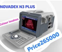 TOSHIBA JAPAN COLOUR DOPPLAR ULTRASOUND MACHINE  FOR SALE